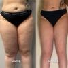 antes y despues de usarlo